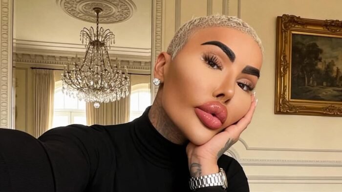 La súbita muerte del influencer que buscaba parecerse a Kim Kardashian ha dejado intrigadas a muchas personas.